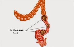 هل تعرفي ما هو الردب ادخلو راح تعرفوا ولعله سبب لعلاج القولون روعه Unnamed File 2203