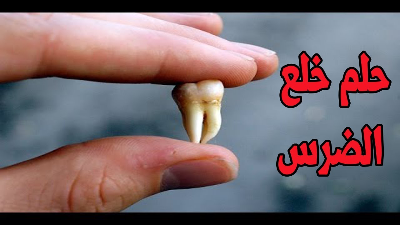 تفسير حلم خلع الضرس المسوس - رؤية الضرس وخلعة 8705 2