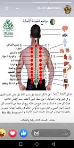 تجربتي مع الحجامة وتخلصي من مشكله روحية بفضل الله