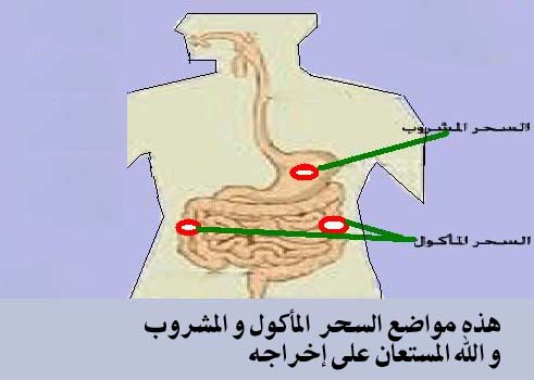 كيف اعرف خروج السحر الماكول - التخلص من الاصابة بالعين 8254 1