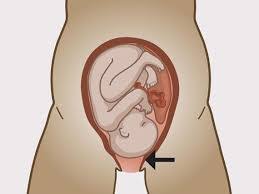 تسريع الولادة وفتح الرحم